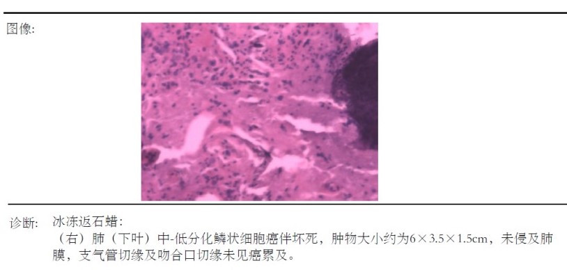 图片[1]-病例1答案 | 每周呼吸-每周呼吸