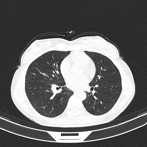 图片[15]-病例4 | 每周呼吸-每周呼吸