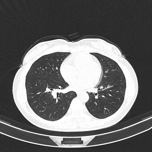 图片[16]-病例4 | 每周呼吸-每周呼吸