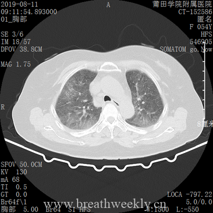 图片[1]-病例库14 | 每周呼吸-每周呼吸