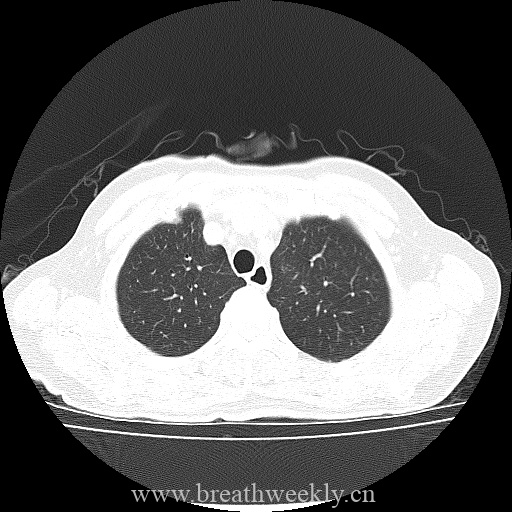 图片[1]-病例库12 | 每周呼吸-每周呼吸