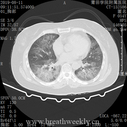 图片[6]-病例库14 | 每周呼吸-每周呼吸