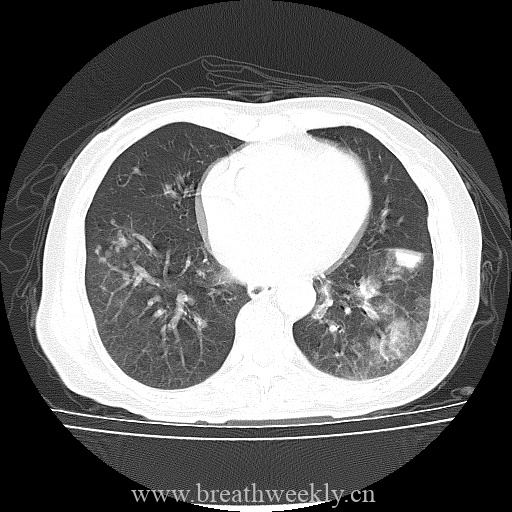 图片[7]-病例库12 | 每周呼吸-每周呼吸