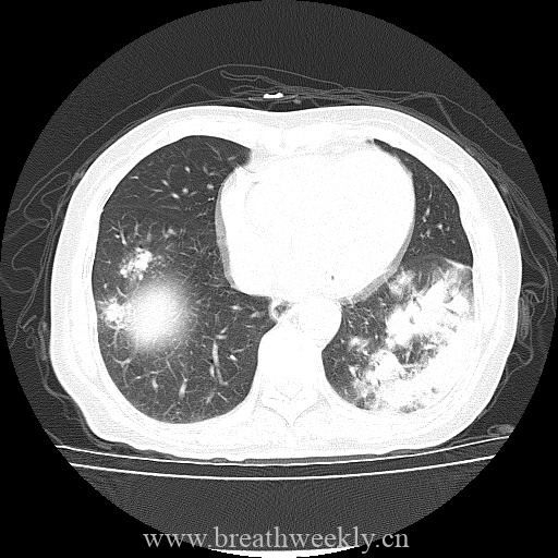 图片[8]-病例库12 | 每周呼吸-每周呼吸