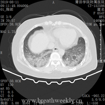 图片[8]-病例库14 | 每周呼吸-每周呼吸