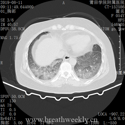 图片[9]-病例库14 | 每周呼吸-每周呼吸