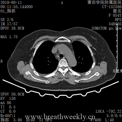 图片[10]-病例库14 | 每周呼吸-每周呼吸