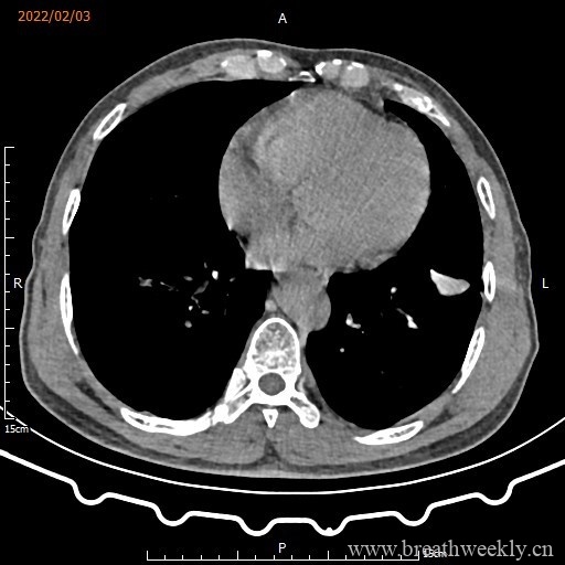 图片[11]-病例16 | 每周呼吸-每周呼吸