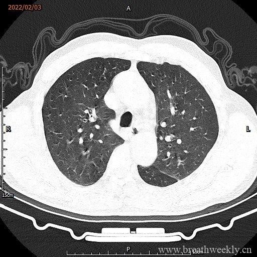 图片[2]-病例16 | 每周呼吸-每周呼吸