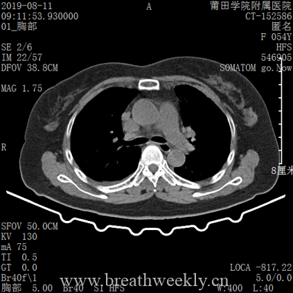 图片[11]-病例库14 | 每周呼吸-每周呼吸