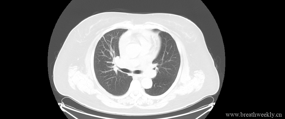 图片[3]-病例18 | 每周呼吸-每周呼吸