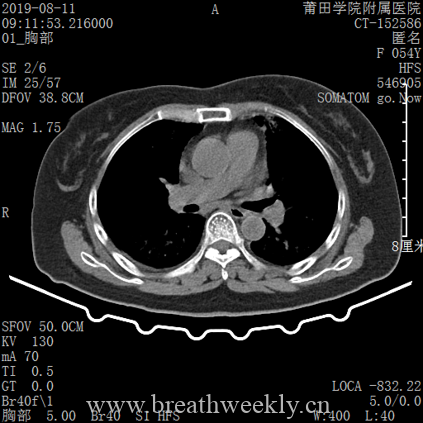 图片[12]-病例库14 | 每周呼吸-每周呼吸