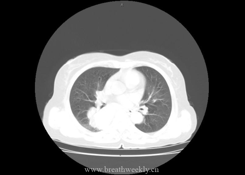图片[5]-病例21 | 每周呼吸-每周呼吸