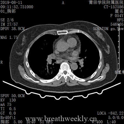 图片[13]-病例库14 | 每周呼吸-每周呼吸