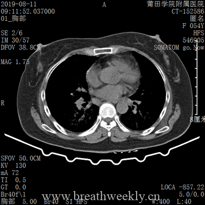 图片[14]-病例库14 | 每周呼吸-每周呼吸