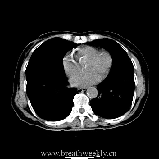 图片[15]-病例库12 | 每周呼吸-每周呼吸