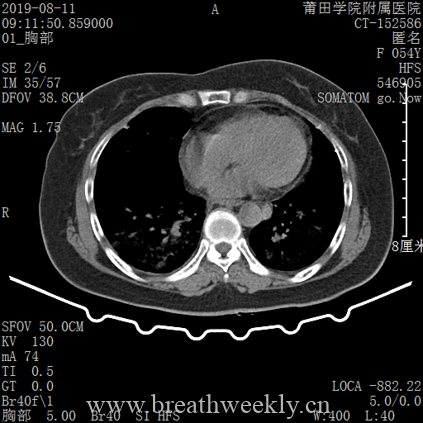 图片[15]-病例库14 | 每周呼吸-每周呼吸