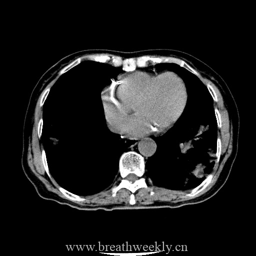 图片[16]-病例库12 | 每周呼吸-每周呼吸