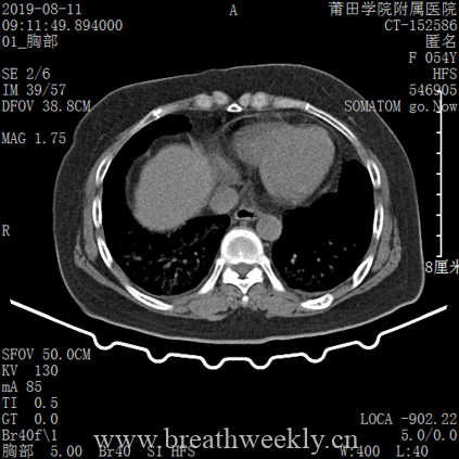 图片[16]-病例库14 | 每周呼吸-每周呼吸
