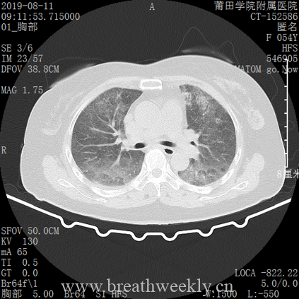 图片[2]-病例库14 | 每周呼吸-每周呼吸