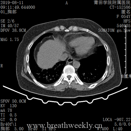 图片[17]-病例库14 | 每周呼吸-每周呼吸