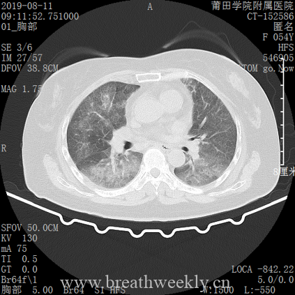 图片[4]-病例库14 | 每周呼吸-每周呼吸