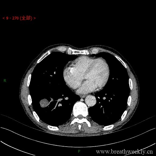 图片[14]-病例库1 | 每周呼吸-每周呼吸