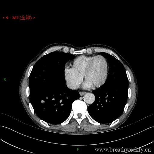 图片[16]-病例库1 | 每周呼吸-每周呼吸