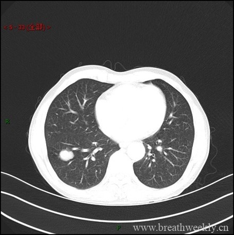 病例库1 | 每周呼吸-每周呼吸