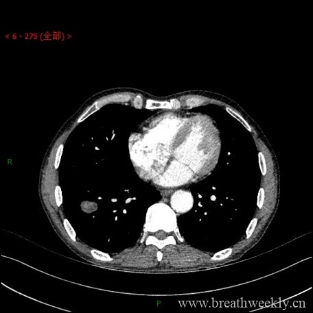 图片[9]-病例库1 | 每周呼吸-每周呼吸