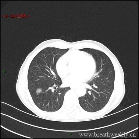 图片[1]-病例库1 | 每周呼吸-每周呼吸