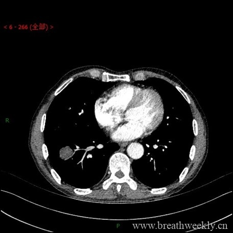 图片[8]-病例库1 | 每周呼吸-每周呼吸