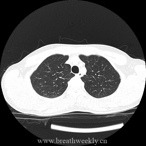 图片[1]-病例库8 | 每周呼吸-每周呼吸