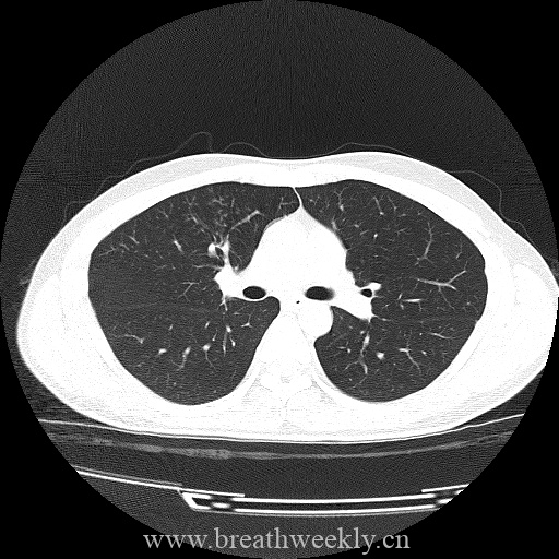 图片[2]-病例库8 | 每周呼吸-每周呼吸