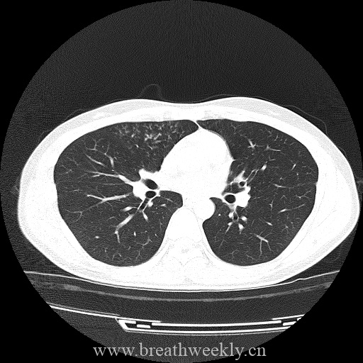 病例库8-每周呼吸