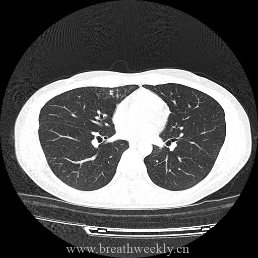 图片[6]-病例库8 | 每周呼吸-每周呼吸
