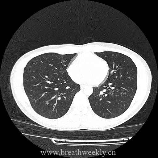 图片[7]-病例库8 | 每周呼吸-每周呼吸