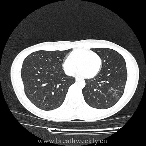 图片[9]-病例库8 | 每周呼吸-每周呼吸