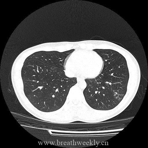 图片[10]-病例库8 | 每周呼吸-每周呼吸