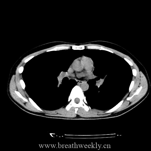 图片[16]-病例库8 | 每周呼吸-每周呼吸