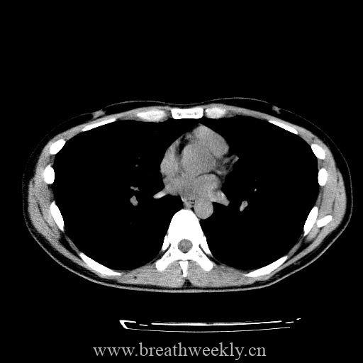 图片[18]-病例库8 | 每周呼吸-每周呼吸