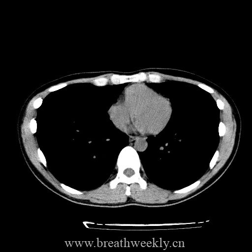 图片[19]-病例库8 | 每周呼吸-每周呼吸