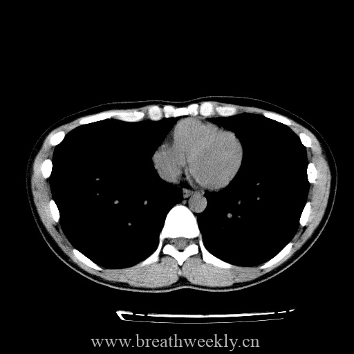 图片[20]-病例库8 | 每周呼吸-每周呼吸
