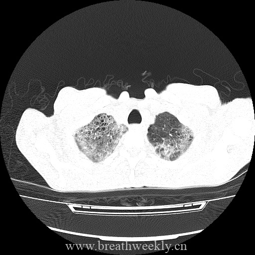 图片[1]-病例库9 | 每周呼吸-每周呼吸
