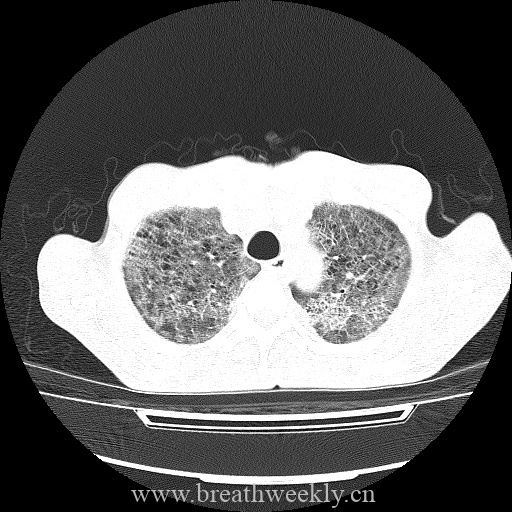 图片[2]-病例库9 | 每周呼吸-每周呼吸