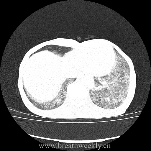 图片[9]-病例库9 | 每周呼吸-每周呼吸