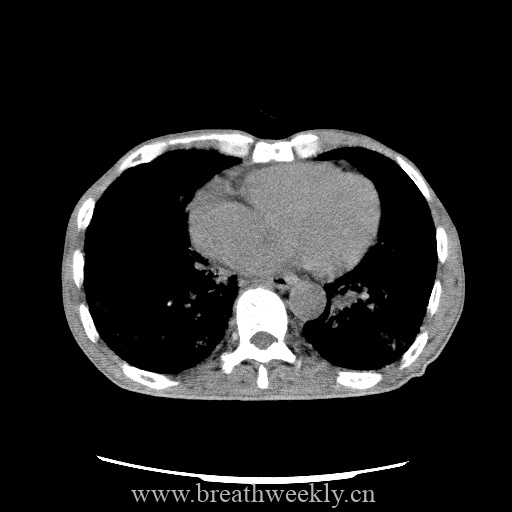 图片[17]-病例库9 | 每周呼吸-每周呼吸