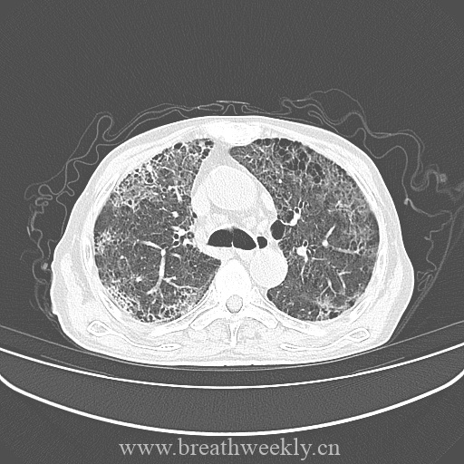 图片[3]-病例库10 | 每周呼吸-每周呼吸