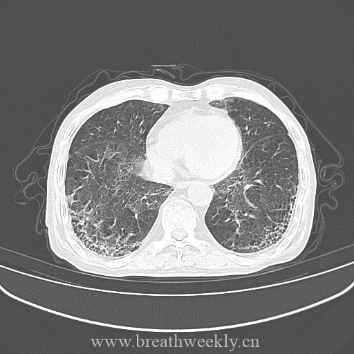 图片[6]-病例库10 | 每周呼吸-每周呼吸