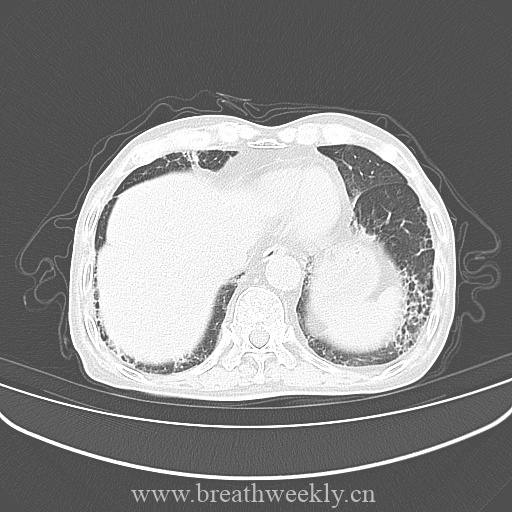 图片[7]-病例库10 | 每周呼吸-每周呼吸